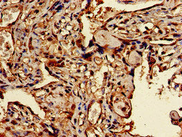 TFEB Antibody – Figure 1 of 3