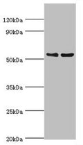 Western blot
All lanes: Transcription factor EB antibody at 3ug/ml
Lane 1: Jurkat whole cell lysate
Lane 2: Mouse brain tissue
Secondary
Goat polyclonal to rabbit IgG at 1/10000 dilution
Predicted band size: 53, 44 kDa
Observed band size: 53 kDa