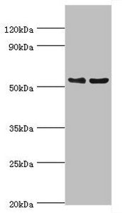 Western blot
All lanes: Transcription factor EB antibody at 3ug/ml
Lane 1: Jurkat whole cell lysate
Lane 2: Mouse brain tissue
Secondary
Goat polyclonal to rabbit IgG at 1/10000 dilution
Predicted band size: 53, 44 kDa
Observed band size: 53 kDa