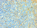 Immunohistochemistry of paraffin-embedded human tonsil tissue using CSB-PA023429ESR2HU at dilution of 1:100