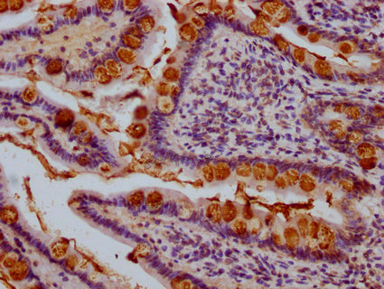 IHC image of CSB-PA023433LA01HU diluted at 1:1000 and staining in paraffin-embedded human small intestine tissue performed on a Leica BondTM system. After dewaxing and hydration, antigen retrieval was mediated by high pressure in a citrate buffer (pH 6.0). Section was blocked with 10% normal goat serum 30min at RT. Then primary antibody (1% BSA) was incubated at 4°C overnight. The primary is detected by a Goat anti-rabbit IgG polymer labeled by HRP and visualized using 0.05% DAB.