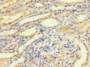 Immunohistochemistry of paraffin-embedded human kidney tissue using CSB-PA023449LA01HU at dilution of 1:100