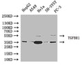 Western Blot Positive WB detected in: HepG2 whole cell lysate, A549 whole cell lysate, Hela whole cell lysate, SH-SY5Y, PC-3 whole cell lysate All lanes: TGFBR1 antibody at 1:1000 Secondary Goat polyclonal to rabbit IgG at 1/50000 dilution Predicted band size: 56, 57, 48kDa Observed band size: 58, 40kDa