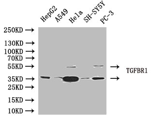 Western Blot Positive WB detected in: HepG2 whole cell lysate, A549 whole cell lysate, Hela whole cell lysate, SH-SY5Y, PC-3 whole cell lysate All lanes: TGFBR1 antibody at 1:1000 Secondary Goat polyclonal to rabbit IgG at 1/50000 dilution Predicted band size: 56, 57, 48kDa Observed band size: 58, 40kDa