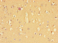 Immunohistochemistry of paraffin-embedded human brain tissue using CSB-PA023452LA01HU at dilution of 1:100