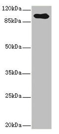 Western blot All lanes: TGFBR3 antibody IgG at 2.39ug/ml + Hela whole cell lysate Secondary Goat polyclonal to rabbit IgG at 1/10000 dilution Predicted band size: 93 kDa Observed band size: 93 kDa