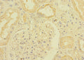 Immunohistochemistry of paraffin-embedded human kidney tissue using CSB-PA023453ESR2HU at dilution of 1:100