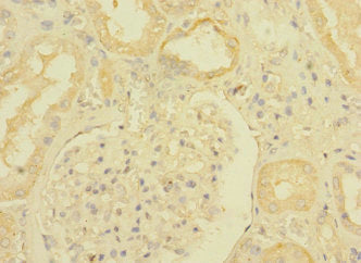 Immunohistochemistry of paraffin-embedded human kidney tissue using CSB-PA023453ESR2HU at dilution of 1:100
