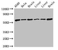 Western Blot
Positive WB detected in: A549 whole cell lysate, Hela whole cell lysate, Rat brain tissue, Rat liver tissue, Mouse liver tissue, Mouse brain tissue
All lanes: TH antibody at 4ug/ml
Secondary
Goat polyclonal to rabbit IgG at 1/50000 dilution
Predicted band size: 59, 56, 57, 46, 45 kDa
Observed band size: 59 kDa