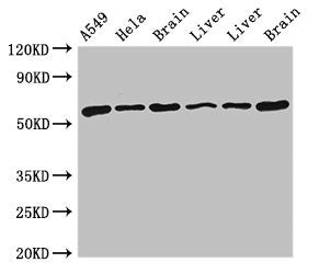 Western Blot
Positive WB detected in: A549 whole cell lysate, Hela whole cell lysate, Rat brain tissue, Rat liver tissue, Mouse liver tissue, Mouse brain tissue
All lanes: TH antibody at 4ug/ml
Secondary
Goat polyclonal to rabbit IgG at 1/50000 dilution
Predicted band size: 59, 56, 57, 46, 45 kDa
Observed band size: 59 kDa