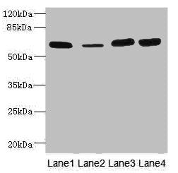 Western blot All lanes: THBD antibody at 3.07µg/ml Lane 1: Rat heart tissue Lane 2: Mouse kidney tissue Lane 3: A549 whole cell lysate Lane 4: A431 whole cell lysate Secondary Goat polyclonal to rabbit IgG at 1/10000 dilution Predicted band size: 60 kDa Observed band size: 60 kDa