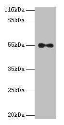 Western blot
All lanes: THRA antibody at 2µg/ml + A431 whole cell lysate
Secondary
Goat polyclonal to rabbit IgG at 1/10000 dilution
Predicted band size: 55, 47, 51 kDa
Observed band size: 55 kDa