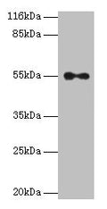THRA Antibody, HRP conjugated – Figure 1 of 3