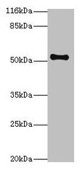 Western blot
All lanes: THRB antibody at 2µg/ml + Mouse liver tissue
Secondary
Goat polyclonal to rabbit IgG at 1/10000 dilution
Predicted band size: 53, 55 kDa
Observed band size: 53 kDa