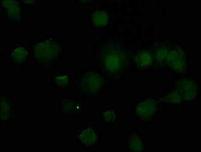 Immunofluorescence staining of MCF-7 cells with CSB-PA023529HA01HU at 1:50, counter-stained with DAPI. The cells were fixed in 4% formaldehyde, permeabilized using 0.2% Triton X-100 and blocked in 10% normal Goat Serum. The cells were then incubated with the antibody overnight at 4°C. The secondary antibody was Alexa Fluor 488-congugated AffiniPure Goat Anti-Rabbit IgG(H+L).