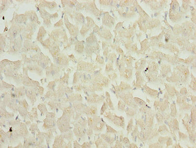 Immunohistochemistry of paraffin-embedded human heart tissue using CSB-PA023560YA01HU at dilution of 1:100