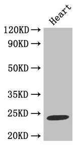 TIMP1 Antibody, Biotin conjugated – Figure 1 of 3
