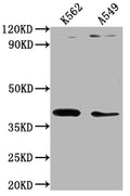 Western Blot
Positive WB detected in: K562 whole cell lysate, A549 whole cell lysate
All lanes: TMOD1 antibody at 1:1000
Secondary
Goat polyclonal to rabbit IgG at 1/50000 dilution
Predicted band size: 41, 27 kDa
Observed band size: 41 kDa