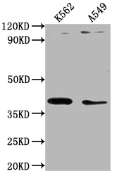 Western Blot
Positive WB detected in: K562 whole cell lysate, A549 whole cell lysate
All lanes: TMOD1 antibody at 1:1000
Secondary
Goat polyclonal to rabbit IgG at 1/50000 dilution
Predicted band size: 41, 27 kDa
Observed band size: 41 kDa