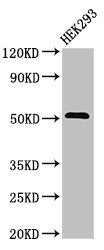 Western Blot
Positive WB detected in: HEK293 whole cell lysate
All lanes: TNFRSF10A antibody at 3.2ug/ml
Secondary
Goat polyclonal to rabbit IgG at 1/50000 dilution
Predicted band size: 51 kDa
Observed band size: 51 kDa