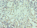 Immunohistochemistry of paraffin-embedded human prostate tissue using CSB-PA023987ESR1HU at dilution of 1:100
