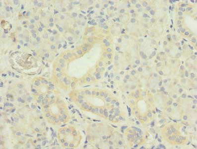 TNFSF12 Antibody, Biotin conjugated – Figure 1 of 2
