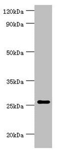 Western blot
All lanes: Tumor necrosis factor ligand superfamily member 13 antibody at 10ug/ml + Hela whole cell lysate
Secondary
Goat polyclonal to rabbit IgG at 1/10000 dilution
Predicted band size: 28, 26, 25, 37, 23 kDa
Observed band size: 28 kDa