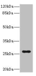Western blot All lanes: TNFSF15 antibody IgG at 0.87ug/ml + Mouse lung tissue Secondary Goat polyclonal to rabbit IgG at 1/10000 dilution Predicted band size: 29, 22, 21 kDa Observed band size: 29 kDa
