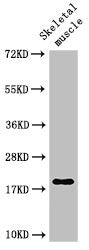 Western Blot
Positive WB detected in: Rat skeletal muscle tissue
All lanes: TNNC1 antibody at 3ug/ml
Secondary
Goat polyclonal to rabbit IgG at 1/50000 dilution
Predicted band size: 19 kDa
Observed band size: 19 kDa