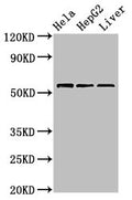 Western Blot
Positive WB detected in: Hela whole cell lysate, HepG2 whole cell lysate, Mouse liver tissue
All lanes: TOM1 antibody at 2.4µg/ml
Secondary
Goat polyclonal to rabbit IgG at 1/50000 dilution
Predicted band size: 54, 49, 51 kDa
Observed band size: 54 kDa