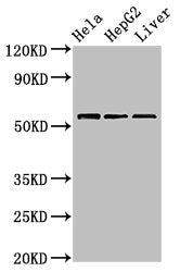 Western Blot
Positive WB detected in: Hela whole cell lysate, HepG2 whole cell lysate, Mouse liver tissue
All lanes: TOM1 antibody at 2.4µg/ml
Secondary
Goat polyclonal to rabbit IgG at 1/50000 dilution
Predicted band size: 54, 49, 51 kDa
Observed band size: 54 kDa