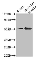 Western Blot
Positive WB detected in: Mouse heart tissue, Mouse skeletal muscle tissue
All lanes: TPH1 antibody at 2.5µg/ml
Secondary
Goat polyclonal to rabbit IgG at 1/50000 dilution
Predicted band size: 51, 54 kDa
Observed band size: 51 kDa