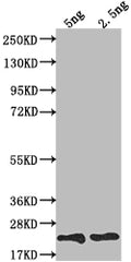 Western Blot
Positive WB detected in Recombinant protein
All lanes: TRBC2 antibody at 1:2000
Secondary
Goat polyclonal to rabbit IgG at 1/50000 dilution
Predicted band size: 19.7 kDa
Observed band size: 20 kDa