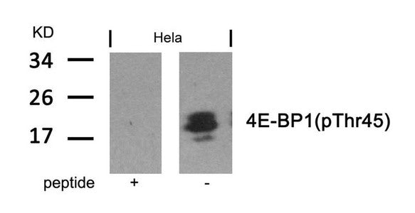 Western blot analysis of extracts from Hela cells using 4E-BP1(Phospho-Thr45) Antibody and the same antibody preincubated with blocking peptide.