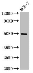 Western Blot
Positive WB detected in: MCF-7 whole cell lysate
All lanes: TWIST1 antibody at 3µg/ml
Secondary
Goat polyclonal to rabbit IgG at 1/50000 dilution
Predicted band size: 21 kDa
Observed band size: 50 kDa