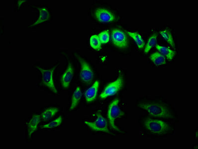 Immunofluorescence staining of A549 cells with CSB-PA025399LA01HU at 1:133, counter-stained with DAPI. The cells were fixed in 4% formaldehyde, permeabilized using 0.2% Triton X-100 and blocked in 10% normal Goat Serum. The cells were then incubated with the antibody overnight at 4°C. The secondary antibody was Alexa Fluor 488-congugated AffiniPure Goat Anti-Rabbit IgG(H+L).