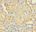 Immunohistochemistry of paraffin-embedded human kidney tissue using CSB-PA025435LA01HU at dilution of 1:100
