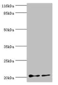 UBE2C Antibody, Biotin conjugated – Figure 1 of 3