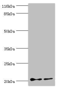 UBE2C Antibody, HRP conjugated – Figure 1 of 3