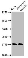 Western Blot
Positive WB detected in: Hela whole cell lysate, Rat skeletal muscle tissue
All lanes: UBE2D3 antibody at 4.8µg/ml
Secondary
Goat polyclonal to rabbit IgG at 1/50000 dilution
Predicted band size: 17 kDa
Observed band size: 17 kDa