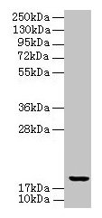 Western blot
All lanes: UBE2G2 antibody at 8µg/ml + K562 whole cell lysate
Secondary
Goat polyclonal to rabbit IgG at 1/10000 dilution
Predicted band size: 19, 16 kDa
Observed band size: 19 kDa