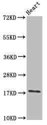 Western Blot
Positive WB detected in: Mouse heart tissue
All lanes: UBE2L3 antibody at 3ug/ml
Secondary
Goat polyclonal to rabbit IgG at 1/50000 dilution
Predicted band size: 18, 15, 25 kDa
Observed band size: 18 kDa