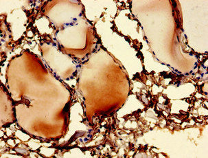 UBE2V1 Antibody, Biotin conjugated – Figure 1 of 1
