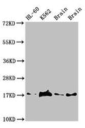 Western Blot
Positive WB detected in: HL60 whole cell lysate, K562 whole cell lyaste, Mouse brain tissue, Rat brain tissue
All lanes: UBE2V2 antibody at 1.5µg/ml
Secondary
Goat polyclonal to rabbit IgG at 1/50000 dilution
Predicted band size: 17 kDa
Observed band size: 17 kDa