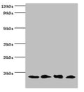 Western blot All lanes: UBE2V2 antibody at 3µg/ml Lane 1: Hela whole cell lysate Lane 2: Mouse brain tissue Lane 3: Jurkat whole cell lysate Lane 4: K562 whole cell lysate Secondary Goat polyclonal to rabbit IgG at 1/10000 dilution Predicted band size: 16 kDa Observed band size: 16 kDa
