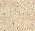 Immunohistochemistry of paraffin-embedded human brain tissue using CSB-PA025484HA01HU at dilution of 1:100