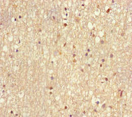 UBE2V2 Antibody, Biotin conjugated – Figure 1 of 1