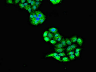 Immunofluorescent analysis of PC-3 cells using CSB-PA025612LA01HU at dilution of 1:100 and Alexa Fluor 488-congugated AffiniPure Goat Anti-Rabbit IgG(H+L)