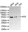 Western Blot
Positive WB detected in: recombinant protein
All lanes: UOX Antibody at 1:1000
Secondary
Goat polyclonal to rabbit IgG at 1/50000 dilution
Predicted band size: 48 kDa
Observed band size: 50 kDa