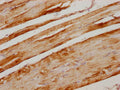 IHC image of CSB-PA025821PA01HU diluted at 1:300 and staining in paraffin-embedded human skeletal muscle tissue performed on a Leica BondTM system. After dewaxing and hydration, antigen retrieval was mediated by high pressure in a citrate buffer (pH 6.0). Section was blocked with 10% normal goat serum 30min at RT. Then primary antibody (1% BSA) was incubated at 4°C overnight. The primary is detected by a biotinylated secondary antibody and visualized using an HRP conjugated SP system.